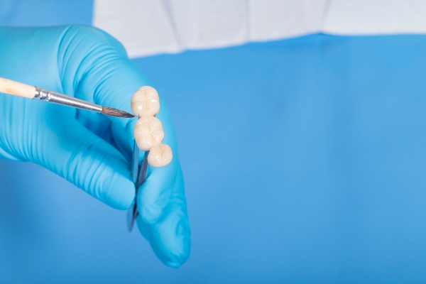 The Role Of Dental Bridges In Full Mouth Restorations